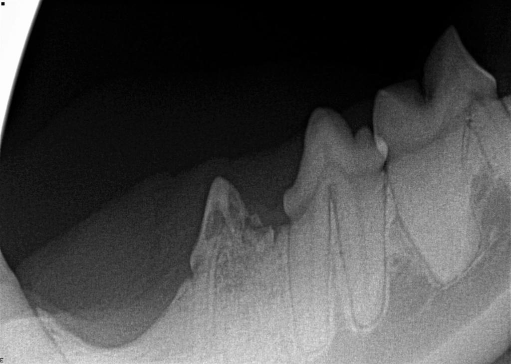 Dental X-Rays