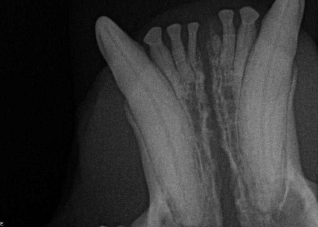 Dental X-Rays