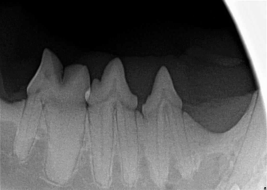 Dental X-Rays